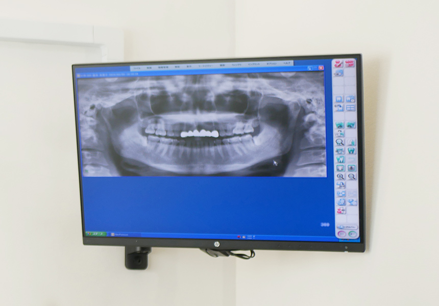 説明用モニター